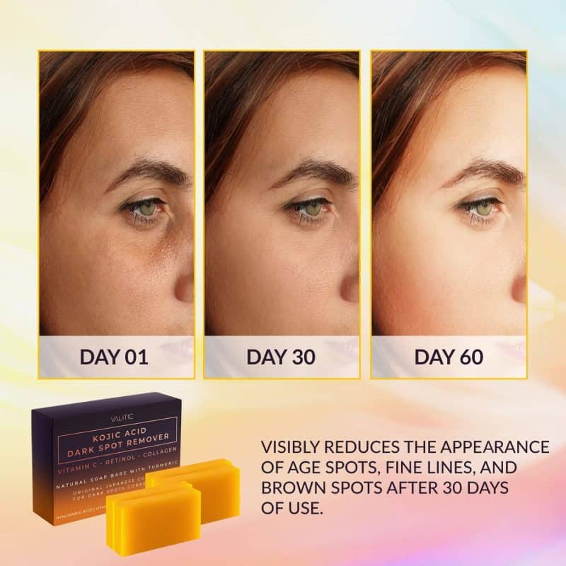 VALITIC Kojic Acid Dark Spot Remover Soap Bar - Image 9