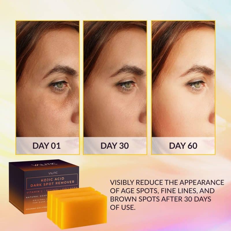 VALITIC Kojic Acid Dark Spot Remover Soap Bar - Image 19