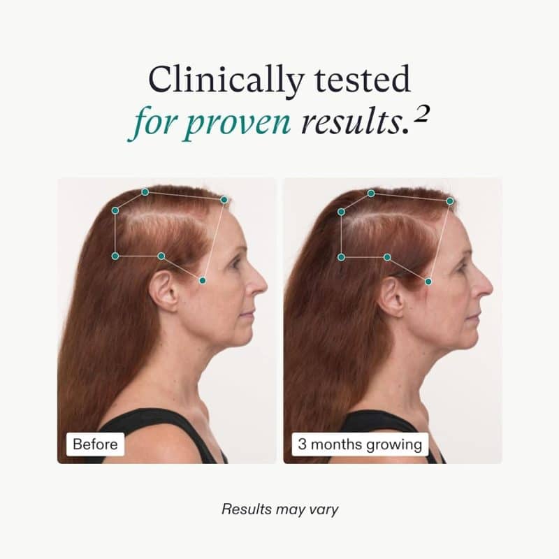Nutrafol Women's Balance Hair Growth Supplements - Image 4