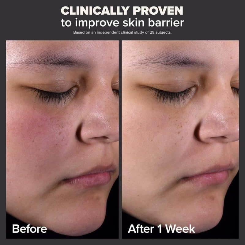 Paula's Choice SKIN PERFECTING 2% BHA Liquid Salicylic Acid Exfoliant - Image 2
