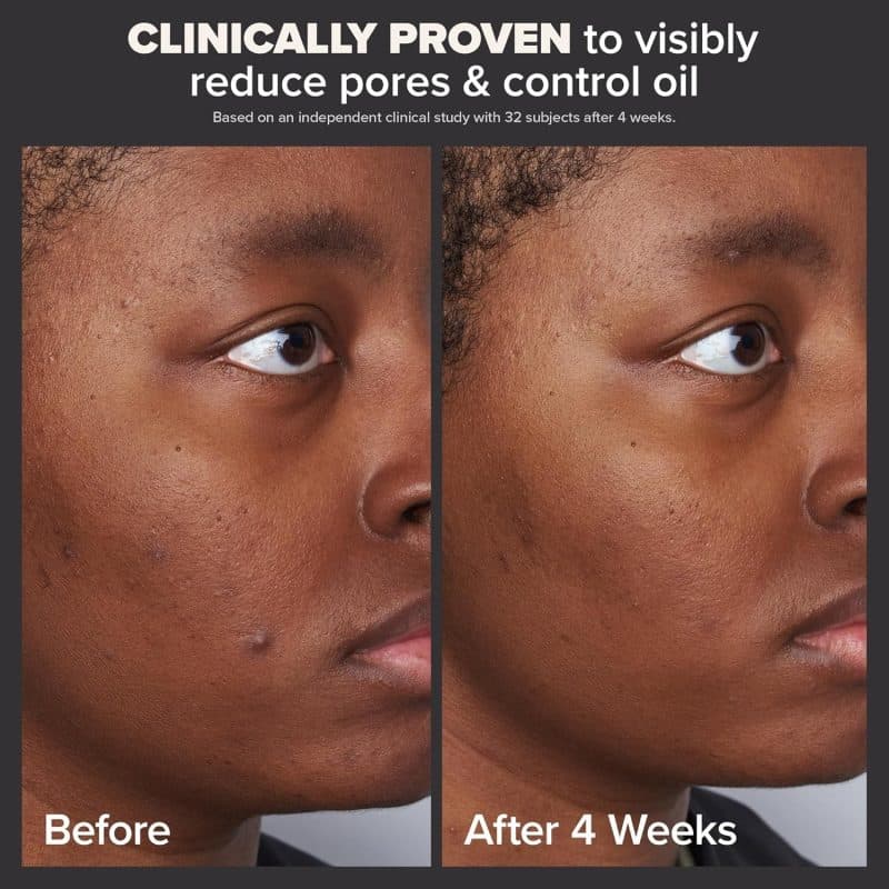 Paula's Choice SKIN PERFECTING 2% BHA Liquid Salicylic Acid Exfoliant - Image 3