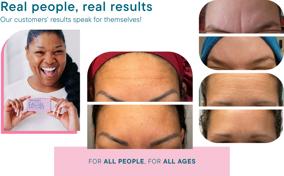 invisible sio lifting puffy frown beauty deep eyes smoothies remover eleven folds