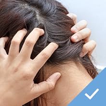 Person grabbing head - helps control seborrheic dermatitis