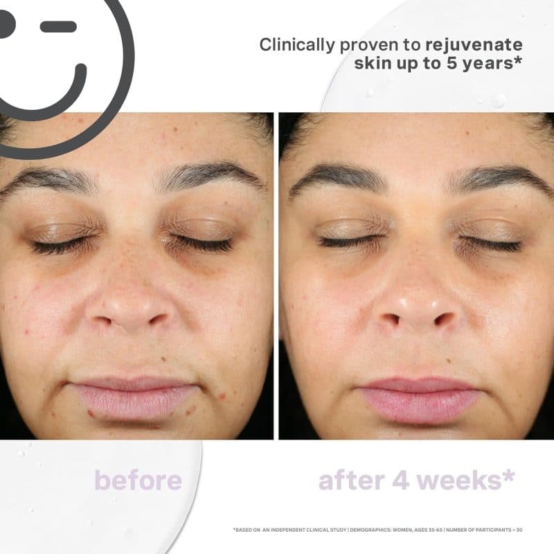 Kate Somerville KateCeuticals® SuperCell Rejuvenation Serum - Image 5
