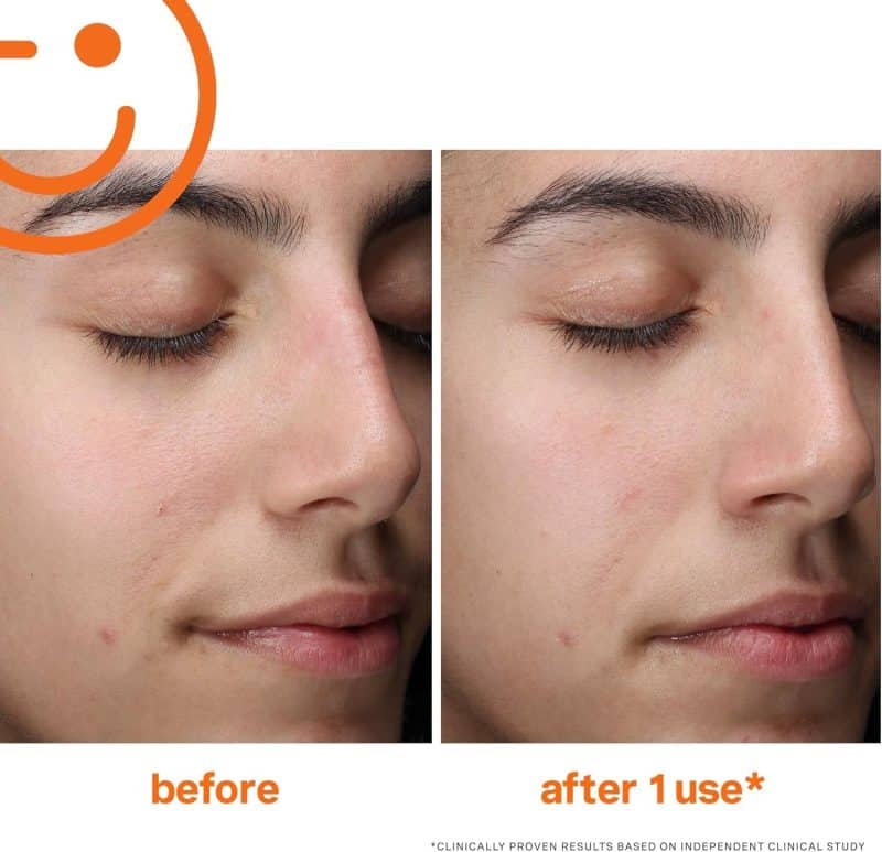 Kate Somerville ExfoliKate Cleanser - Image 14