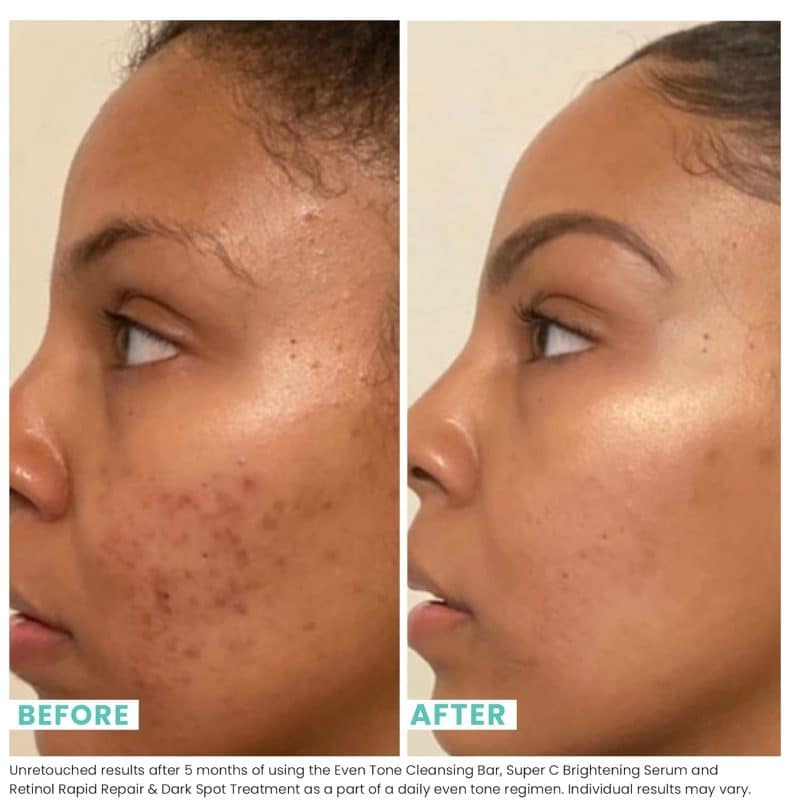 Urban Skin Rx® Even Tone Cleansing Bar - Image 4