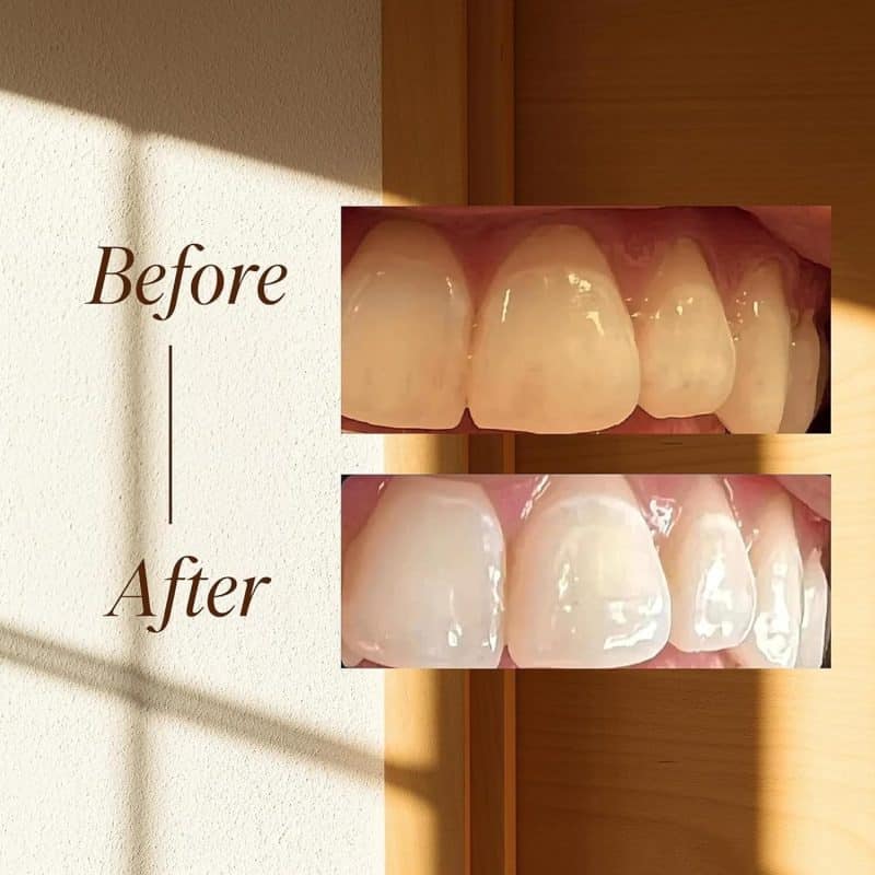 Boka Fluoride Free Toothpaste - Image 53